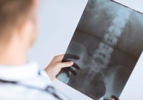 doctor holding x-ray or roentgen image doctor holding x-ray or roentgen image
