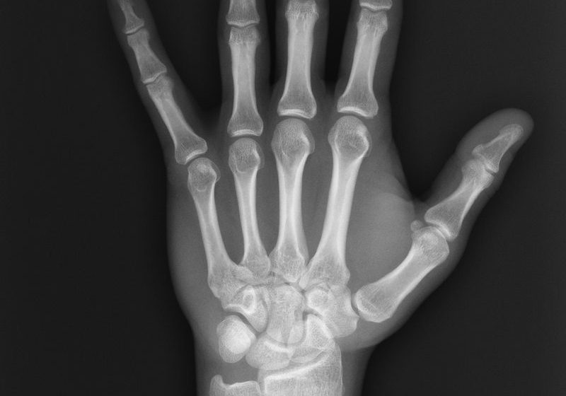 the-history-of-x-ray-technology the-history-of-x-ray-technology