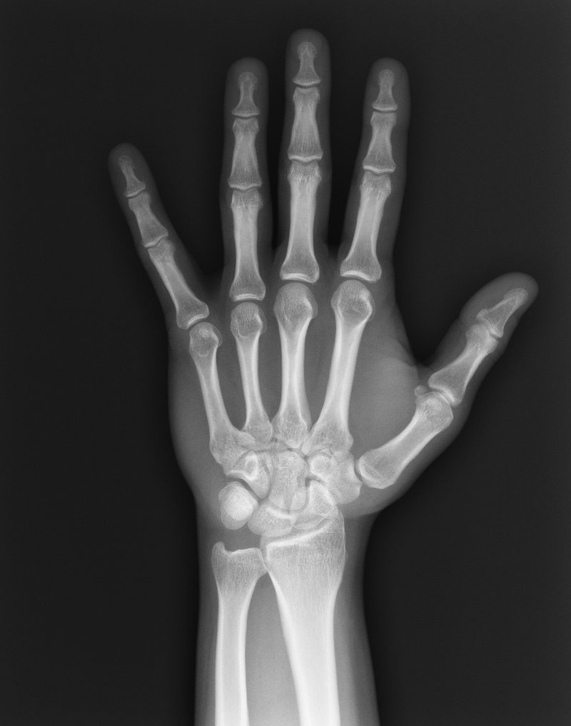 the-history-of-x-ray-technology